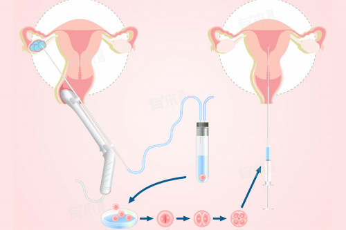 供精助孕医院排名与成功率解析