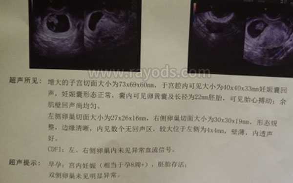 芜湖供卵多少钱一颗_子宫肌瘤怀孕难，泰国第三代试管婴儿官宣怀孕