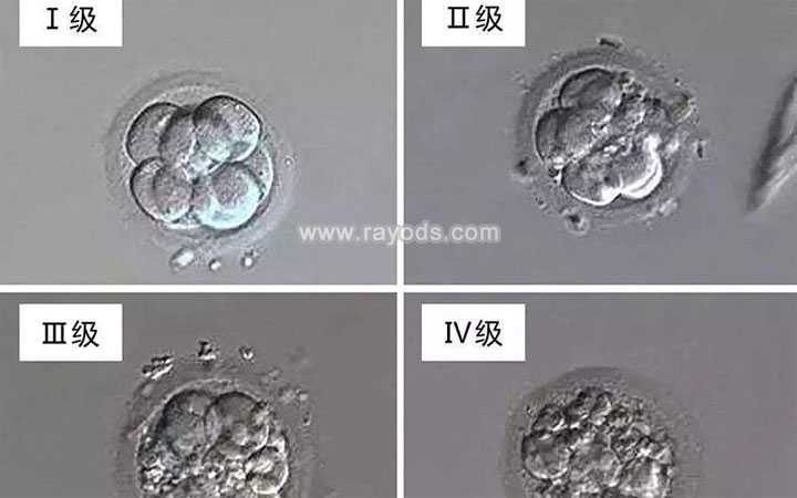 漯河怎样寻找供卵者_漯河供卵试管婴儿是自己的孩子吗_二代试管培养的胚胎质