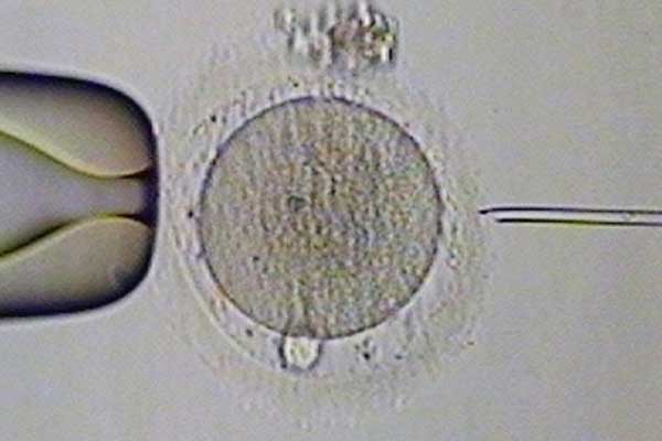 枣庄代孕哪里便宜_俄罗斯试管婴儿基因检测对囊胚会有伤害吗？