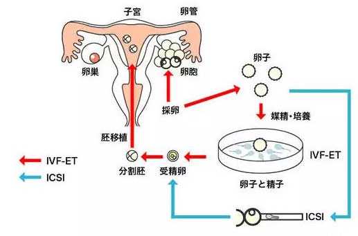 石家庄诺贝尓代孕中心_石家庄代孕公司是什么_贵州首个“第三代试管婴儿”出