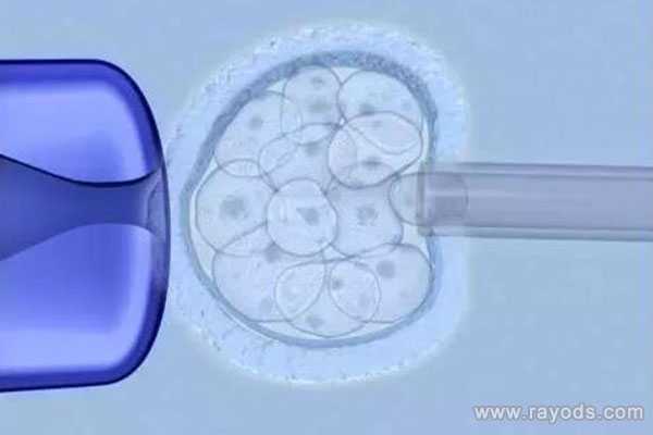 衢州代孕包生儿子_衢州今年代孕价格_降调在做试管婴儿中的重要作用